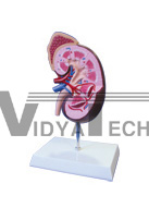 The dissection model of kidney